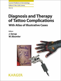 Diagnosis and Therapy of Tattoo Complications (eBook, ePUB)