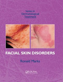 Cover Facial Skin Disorders