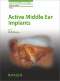 Active Middle Ear Implants (eBook, ePUB)