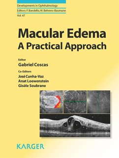 Cover Macular Edema (eBook, ePUB)