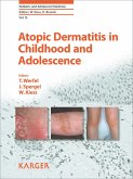 Atopic Dermatitis in Childhood and Adolescence (eBook, ePUB)