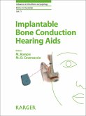Implantable Bone Conduction Hearing Aids (eBook, ePUB)