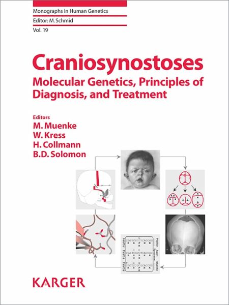 Craniosynostoses (eBook, ePUB) Craniosynostoses (eBook, ePUB)