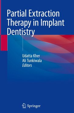 Partial Extraction Therapy in Implant Dentistry