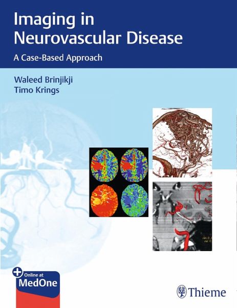 Imaging in Neurovascular Disease (eBook, PDF) Imaging in Neurovascular Disease (eBook, PDF)