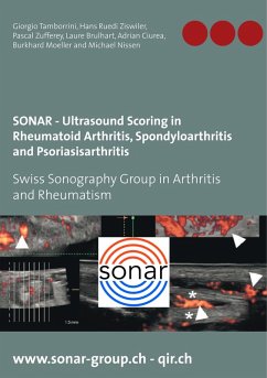 SONAR - Ultrasound Scoring in Rheumatoid Arthritis, Spondyloarthritis and Psoriasisarthritis (eBook, ePUB)