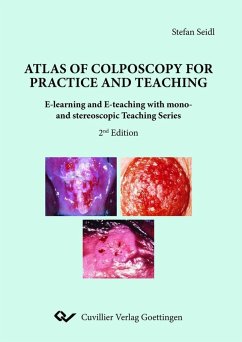Cover Atlas of Colposcopy for Practice and Teaching (eBook, PDF)