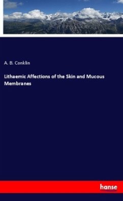 Lithaemic Affections of the Skin and Mucous Membranes - Conklin, A. B.