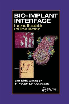 Bio-Implant Interface - Ellingsen, J E; Lyngstadaas, S P