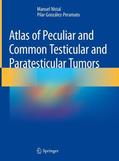 Atlas of Peculiar and Common Testicular and Paratesticular Tumors (eBook, PDF) - Nistal, Manuel; González-Peramato, Pilar