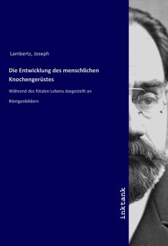 Die Entwicklung des menschlichen Knochengerüstes - Lambertz, Joseph