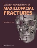 Surgical Management of Maxillofacial Fractures (eBook, PDF)