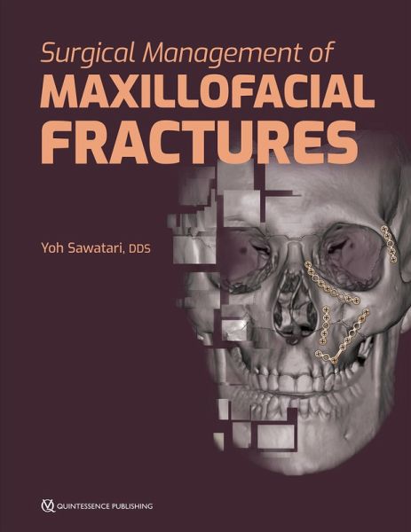 Surgical Management of Maxillofacial Fractures (eBook, ePUB) Surgical Management of Maxillofacial Fractures (eBook, ePUB)
