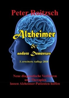 Alzheimer & andere Demenzen - Roitzsch, Peter