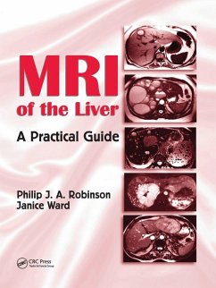 Cover MRI of the Liver