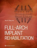 Full-Arch Implant Rehabilitation (eBook, PDF)
