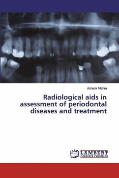 Radiological aids in assessment of periodontal diseases and treatment - Mishra, Ashank