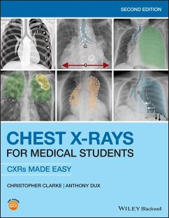 Chest X-Rays for Medical Students - Clarke, Christopher (ST2 Clinical Radiology Trainee at Nottingham Un; Dux, Anthony (Consultant Radiologist at University Hospitals of Leic