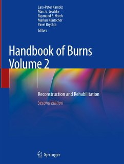 Handbook of Burns Volume 2