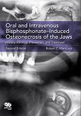 Oral and Intravenous Bisphosphonate-Induced Osteonecrosis of the Jaws (eBook, ePUB)