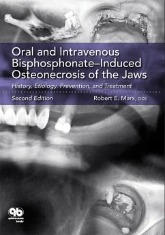 Oral and Intravenous Bisphosphonate-Induced Osteonecrosis of the Jaws (eBook, PDF) - Marx, Robert E.