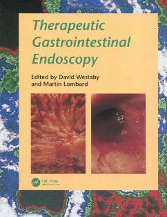 Therapeutic Gastrointestinal Endoscopy (eBook, PDF)