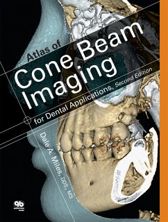 Atlas of Cone Beam Imaging for Dental Applications (eBook, PDF) - Miles, Dale A.