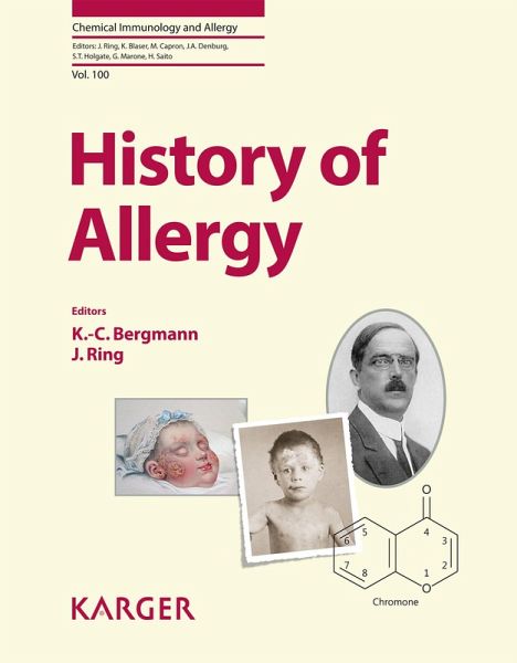 History of Allergy (eBook, ePUB) History of Allergy (eBook, ePUB)