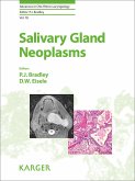 Salivary Gland Neoplasms (eBook, ePUB)