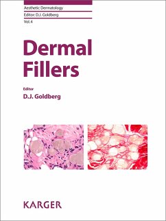 Dermal Fillers (eBook, ePUB)