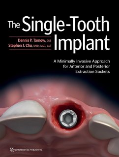 Cover The Single-Tooth Implant: (eBook, PDF)