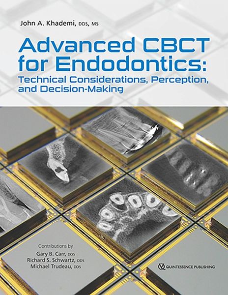 Advanced CBCT for Endodontics (eBook, ePUB)
