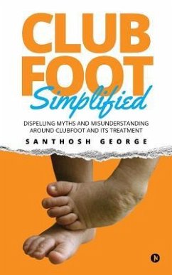 Clubfoot Simplified: Dispelling Myths and Misunderstanding around Clubfoot and its treatment - George, Santhosh