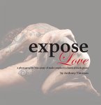 expose Love