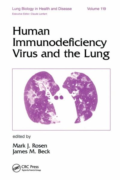 Human Immunodeficiency Virus and the Lung (eBook, PDF)