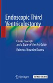 Endoscopic Third Ventriculostomy (eBook, PDF)