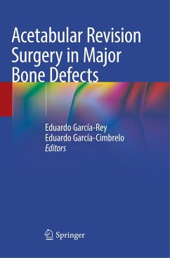 Acetabular Revision Surgery in Major Bone Defects