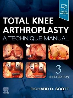Total Knee Arthroplasty - Scott, Richard D