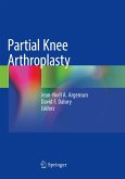 Partial Knee Arthroplasty