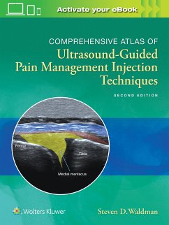 Comprehensive Atlas of Ultrasound-Guided Pain Management Injection Techniques - Waldman, Steven