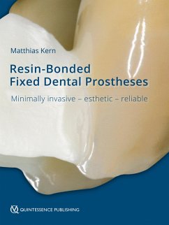 Resin-Bonded Fixed Dental Prostheses (eBook, ePUB) - Kern, Matthias