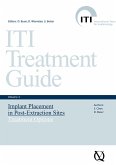 Implant Placement in Post-Extraction Sites (eBook, ePUB)