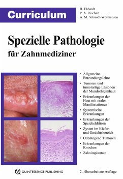 Curriculum Spezielle Pathologie für Zahnmediziner (eBook, ePUB) - Ebhardt, Harald; Reichart, Peter A.; Schmidt-Westhausen, Andrea Maria