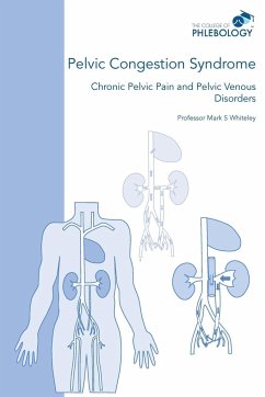 Pelvic Congestion Syndrome - Chronic Pelvic Pain and Pelvic Venous Disorders - Whiteley, Mark S