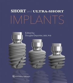 Short and Ultra-Short Implants (eBook, ePUB) - Deporter, Douglas