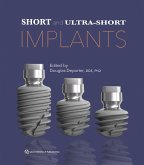Short and Ultra-Short Implants (eBook, PDF)