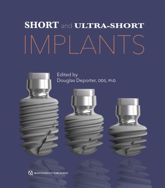 Short and Ultra-Short Implants (eBook, PDF) Short and Ultra-Short Implants (eBook, PDF)