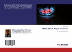 Mandibular Angle Fracture