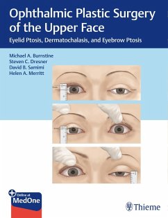 Ophthalmic Plastic Surgery of the Upper Face (eBook, PDF) - Burnstine, Michael A.; Dresner, Steven C.; Samimi, David B.; Merritt, Helen A.
