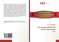 Les endoprothèses de l'aorte thoracique - Ben Hammamia, Mohamed;Denguir, Raouf